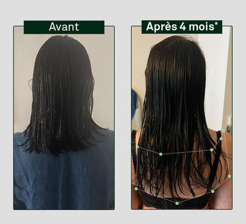 Before and after comparison of hair growth on a person's head, showing visible difference after 4 months.